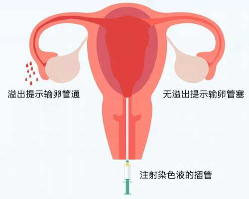 武汉北大医院基本信息,免疫性不孕患者高增，还想要生宝宝怎么办？三代试管