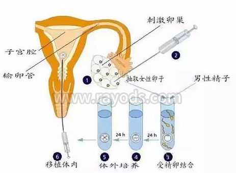 银海区55岁供卵移植囊胚的成功率_赴泰国试管婴儿需办理哪些手续？过程复杂吗