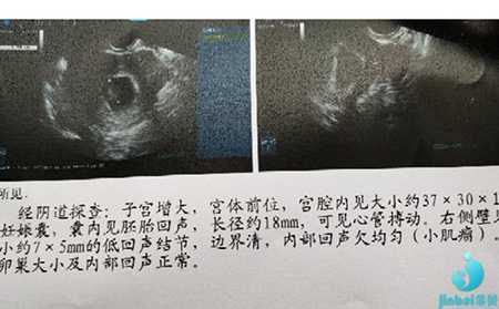 武宁县48岁供卵自怀经历_试管婴儿90%不是自己的？低级胚胎试管成功怀上自己的