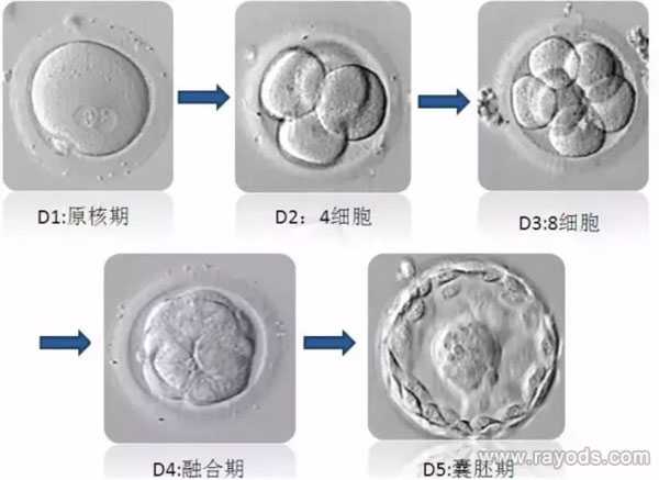 金溪县给别人做代妈_试管胚胎等级分类，二级胚胎是不是优质胚胎？